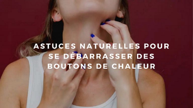 boutons de chaleur