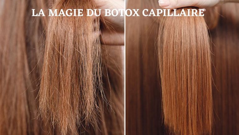 Botox capillaire